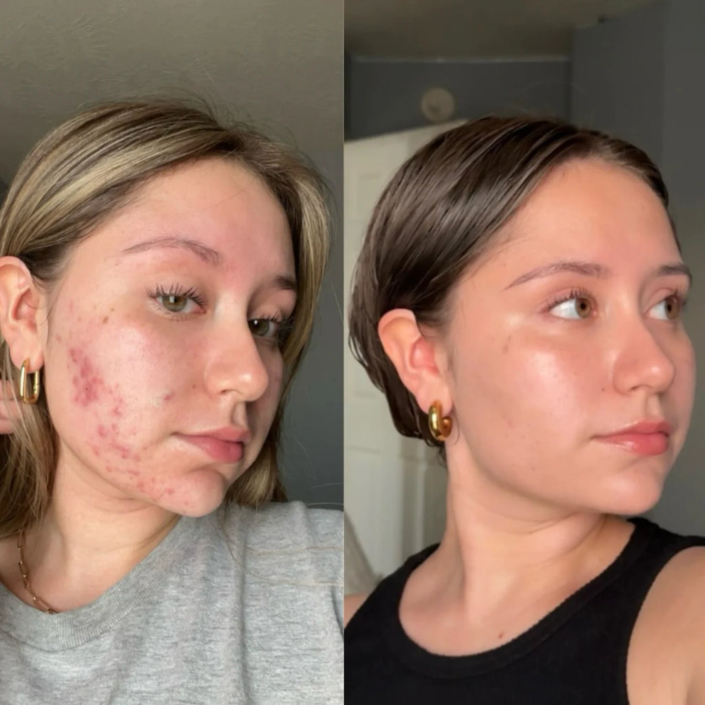 Medicube Glass Glow Skincare Set | 8-Step Hydrating & Radiance Routine